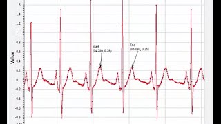 RTI Connext DDS Pro Data Visualization