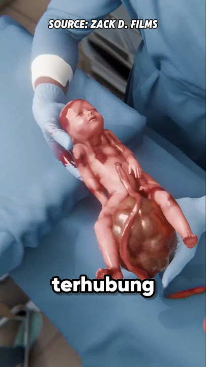 Bayi Ini Lahir Dua Kali 😮 #shorts #facts #tipsandtricks