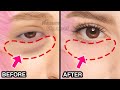 9mins eye bags removal exercise  massage you must do  droopy eyelids dark circles under eyes