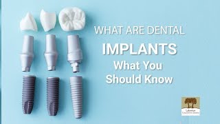 Are you a candidate for dental implants?