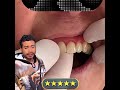 Simplemente vivir sin tus prótesis dentales, después de haberte acostumbrado no es fácil