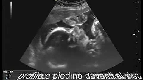 Quanti Kg a 28 settimane di gravidanza?