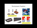 TYPES OF FIXATION USED IN PLASTIC PART (Interior/Exterior Trims)