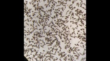 Dense Rotifer Culture