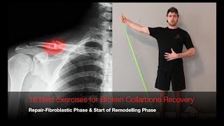 18 Best Exercises for Broken Collarbone Recovery