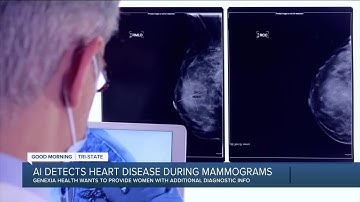 AI helps healthcare detect heart disease during mammograms