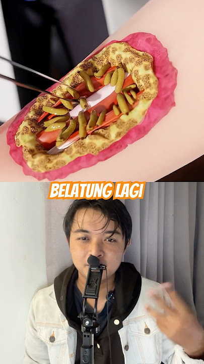 Belatung untuk mengobati luka infeksi di medan tempur #funny #dubbing