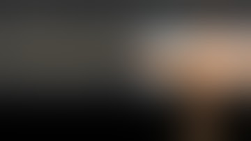 Reconstruction of moderate to severe atrophic alveolar ridge - Part l