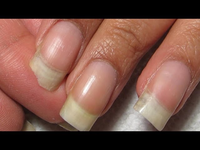 Do Fingernails Need To Breathe? Need To Take A Break Between Manicures –  Emery & Co.