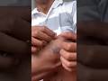 Probiogel Hydrogel Antiseptic Non Alkohol #obatluka #obatkoreng #review #update #fypage #shortvideo