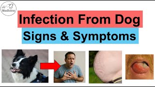 Echinococcosis (Disease From Dogs) Signs & Symptoms (Liver, Lung and Brain Cysts)