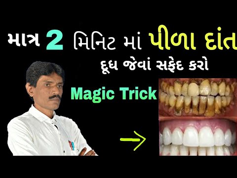 માત્ર 2 મિનીટ માં પીળા દાંત દૂધ જેવા સફેદ કરો || Manhar.D.Patel Official