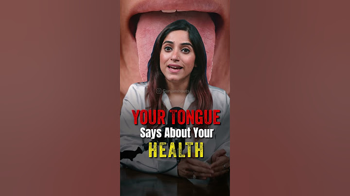 Your Tongue Reveals Health! 👅 White Coating, Cracks, or Redness May Indicate Deficiencies or Issues.