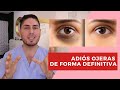 Tratamiento para ojeras / TODO lo que tienes que saber 😱 - #DOCTORLEMUS