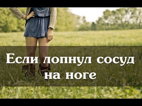 Если лопнул сосуд на ноге