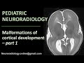 Pediatric neuroradiology  malformations of cortical development part 1