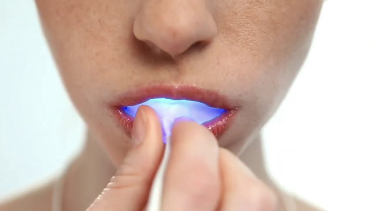 GLO Professional Teeth Whitening Device (Stillwater MN Dentist) YouTube