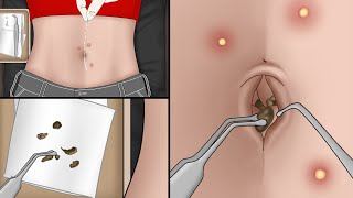 Is Your Belly Button Clean? ASMR Remove Navel Stone Animation | Meng's Stop Motion