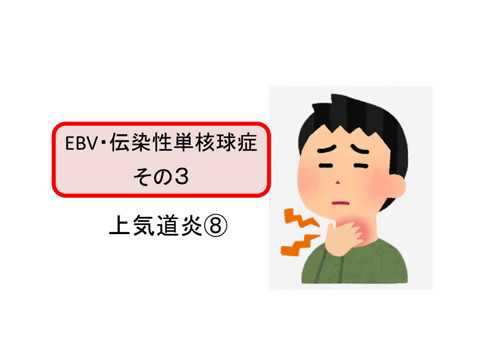 抗菌薬の使い方・上気道炎⑧（医師国家試験）EBV・伝染性単核球症その３