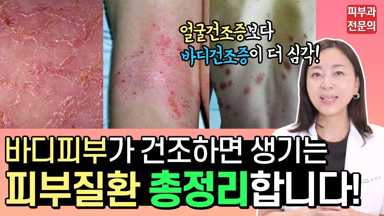 환절기특집) 얼굴피부 건조증보다 바디피부 건조증이 더