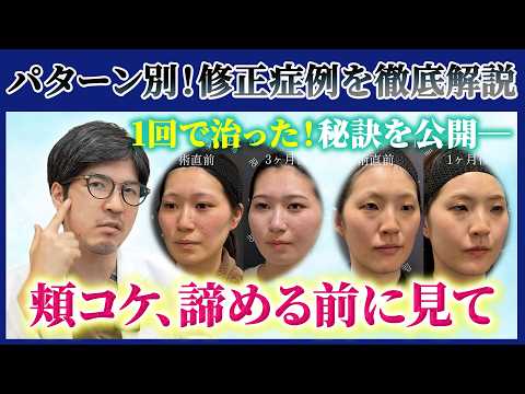 【必見】修正したい人は見て｜パターン別に解説します