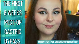 THE FIRST 6 WEEKS POSTOP GASTRIC BYPASS SURGERY | Energy level, pain, and what eating was like!