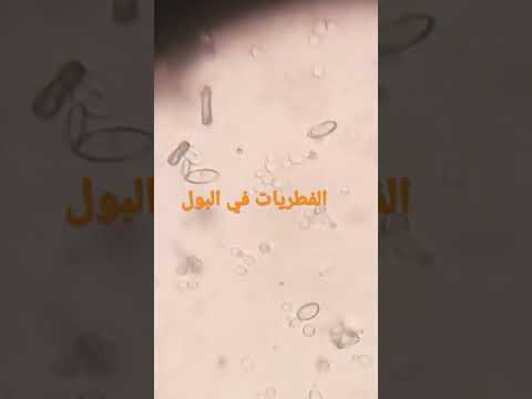 شكل الفطريات في البول تعلم التحاليل الطبية خطوه بخطوه