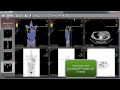 RadiAnt DICOM Viewer 1.0.4 - new features