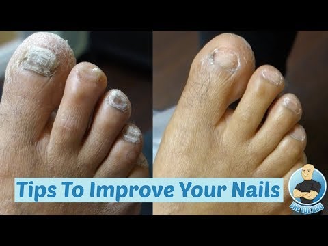 DIY at Home How To Make Your Thick Toenails Look BETTER!!! Cutting of Thick Toenails