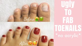 TOENAILS TRANSFORMATION 😍😱*No Acrylic* |•| EASY &amp; SUPER AFFORDABLE |•|