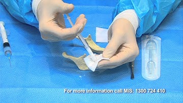 Bone Grafting simplified with BondBone by MIS Video