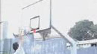 PELVIO CALAMEO - Willy Basket