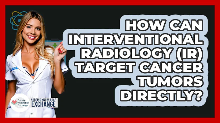 How Can Interventional Radiology (IR) Target Cancer Tumors Directly? - Nursing Knowledge Exchange