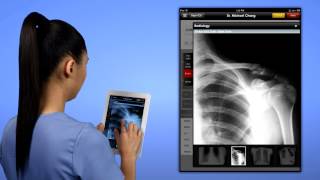 Zoeticx CareIntelligence Product Tour screenshot 5