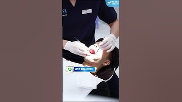 Quy trình trám răng bằng vật liệu Composite tại Peace Dentistry - Thủ Đức
