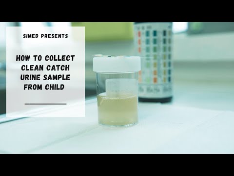 Video: Hoe De Urinetest Van Een Kind Te Doen?
