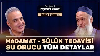 Hacamat -Sülük Tedavisi -Su Orucu Hakkında Detaylar | Bekir Develi ile Peynir Gemisi | Salih Selman