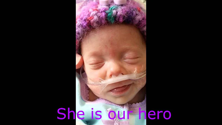 All God's Grace in One Tiny Face. Alyssa's journey