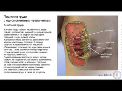 Intimissimi силиконовые накладки на грудь
