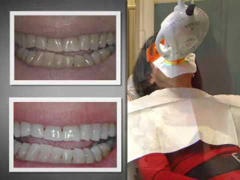 Spring Lake Dental Care Monmouth County New Jersey - YouTube