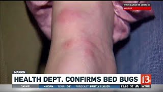 Health Dept. confirms bed bugs
