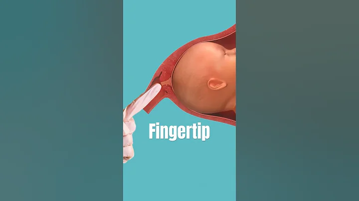 Membrane Sweep Procedure #pregnancy