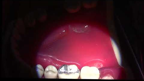 amalgam assessment