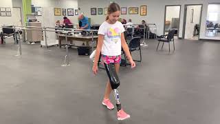 Meg, Knee Disarticulate Amputee - First Prosthesis