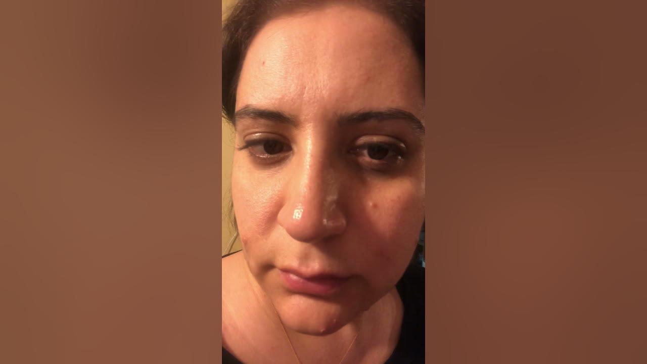 Eyes twitching vitamin deficiency? YouTube