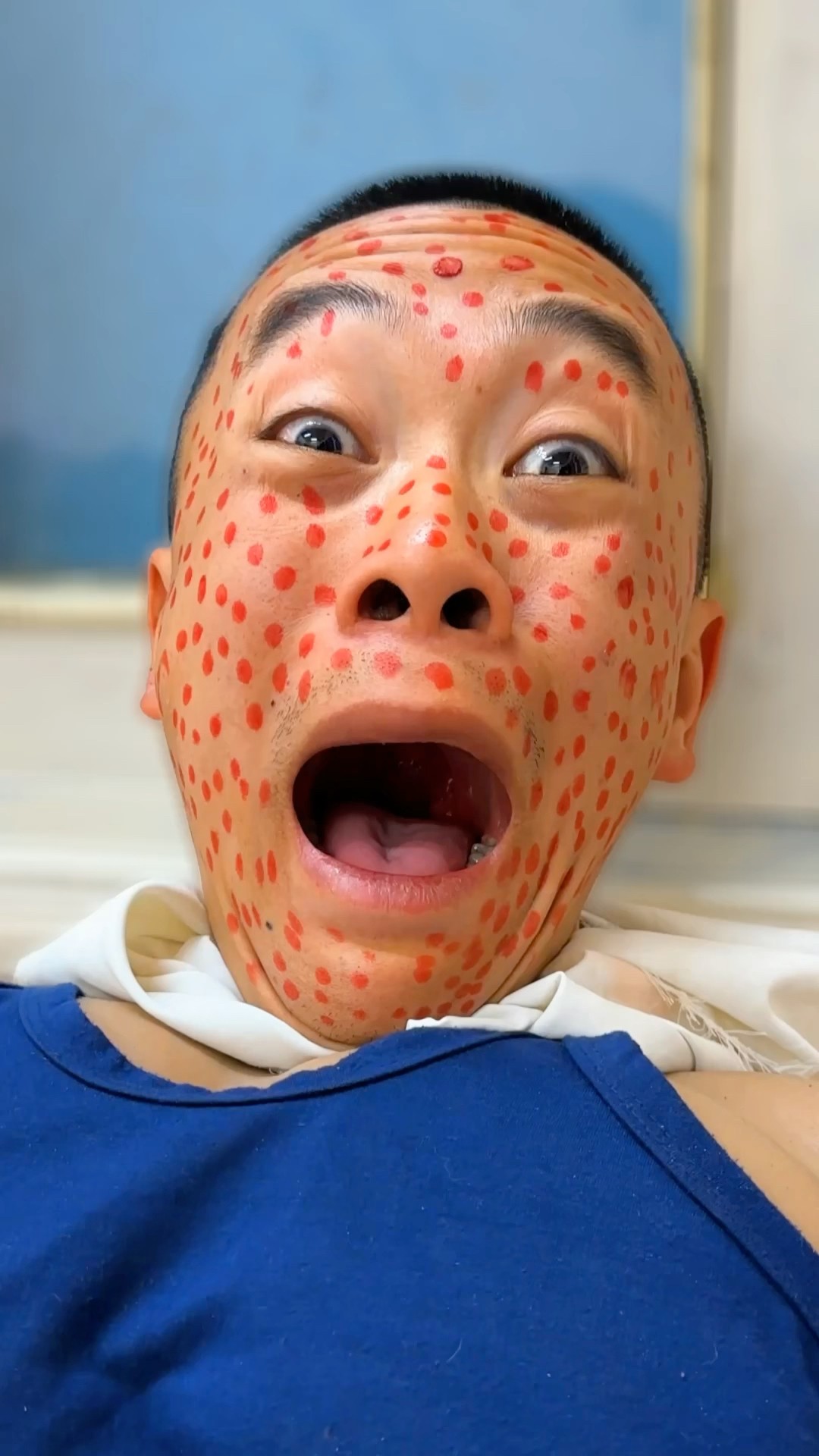ToRung short film: lots of acne?