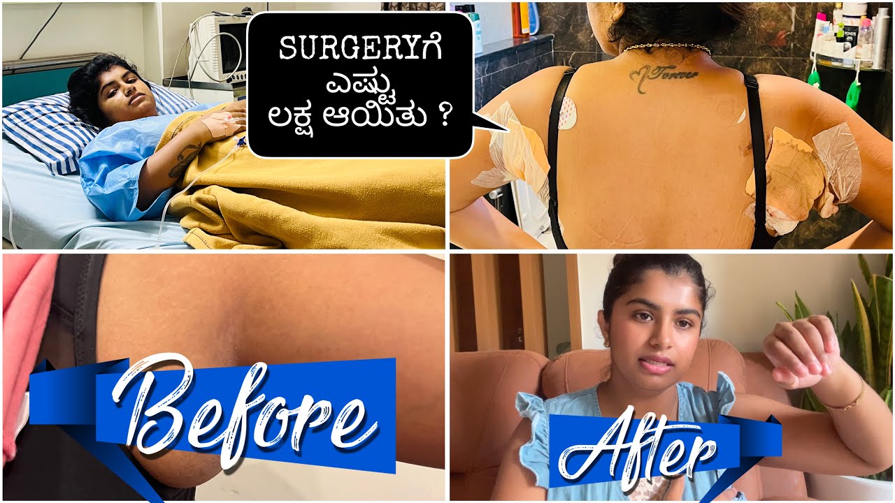 Surgeryಗೆ ಎಷ್ಟು Cost ಆಯಿತು? AfterSurgery ತುಂಬಾ ನೋವು ಅನುಭವಿಸಿದ್ದೀನಿ😭Surgery Details ಕೊಟ್ಟಿದ್ದೀನಿ ನೋಡಿ
