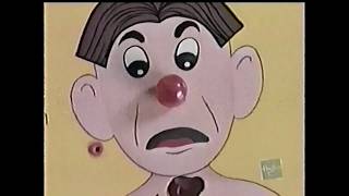 Operation (Hasbro Milton Bradley) TV Commercial - 2003