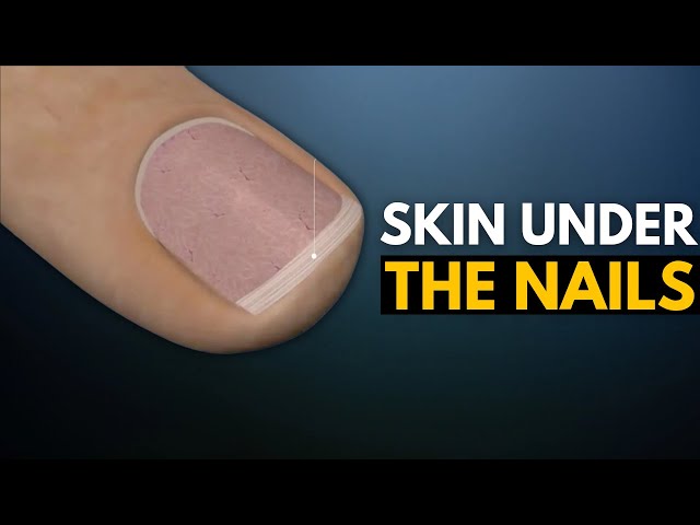 This is a melanoma cancer of the nail. Bands on the nail occur for man... |  TikTok