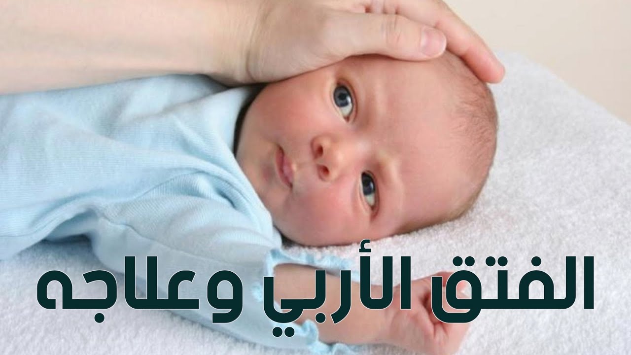 ما هو الفتق الإربي وطرق علاجه في الأطفال